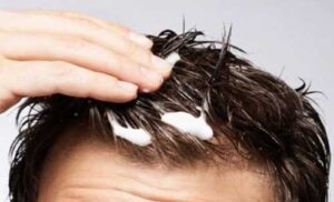 Cara Alami Merawat Rambut Ikal Pria